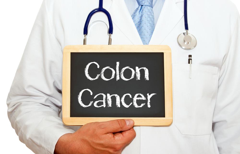 Colon Cancer &#8211; Symptoms, Stages, and Treatment