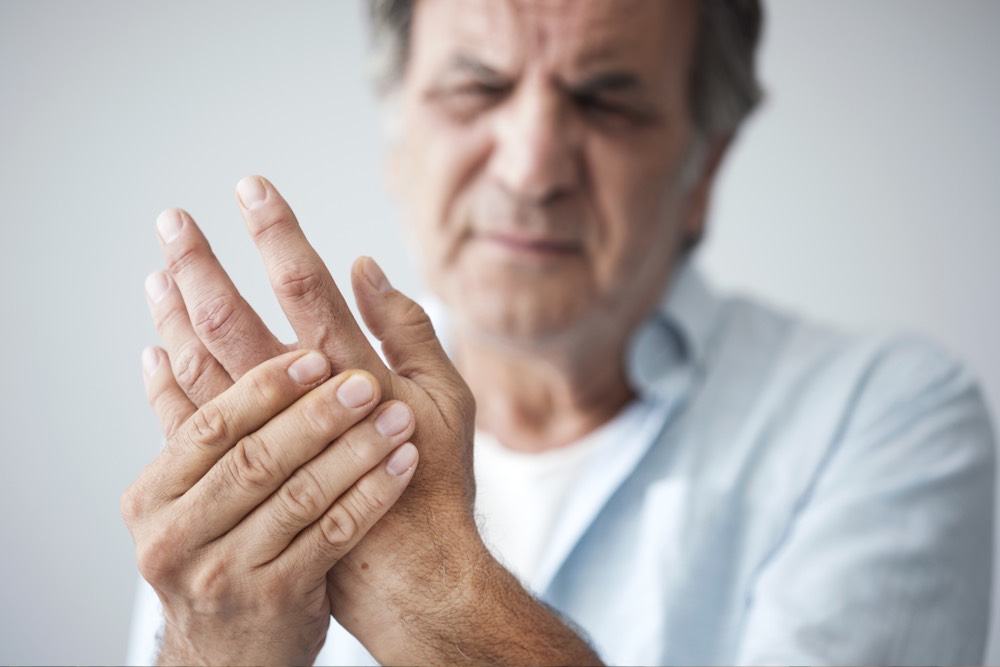 Signs of Rheumatoid Arthritis in Hands