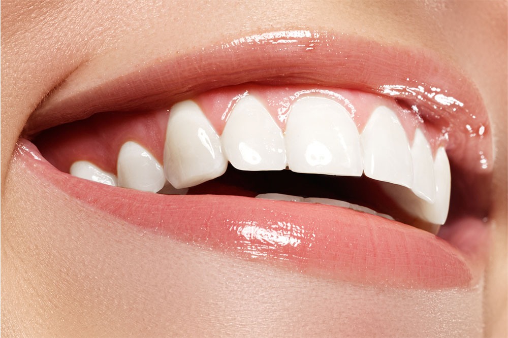 Pros and Cons of Using Teeth-Whitening Products