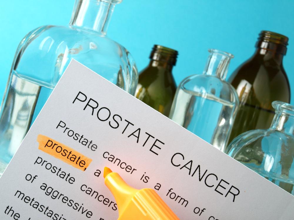 Prostate Cancer &#8211; Risk Factors and Treatment Options