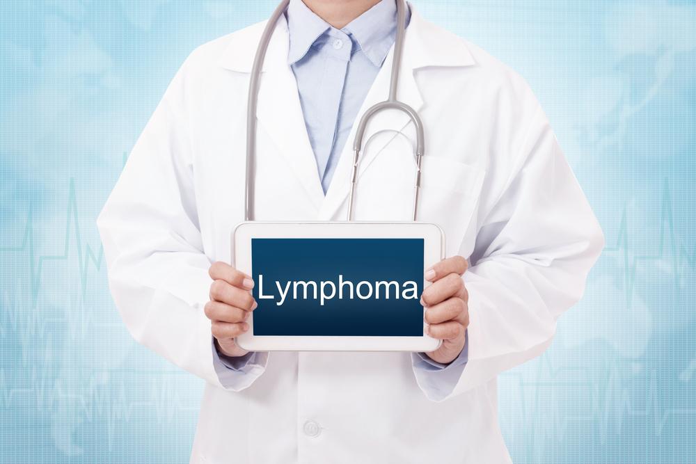 Types and Treatments for Lymphoma