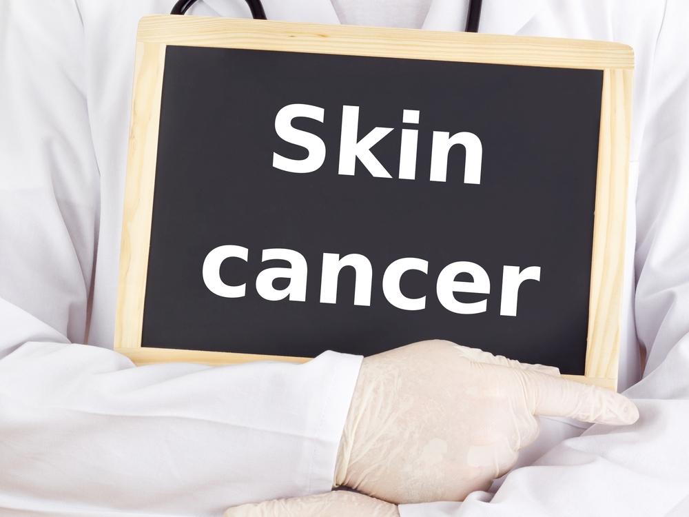 Types of Skin Cancer